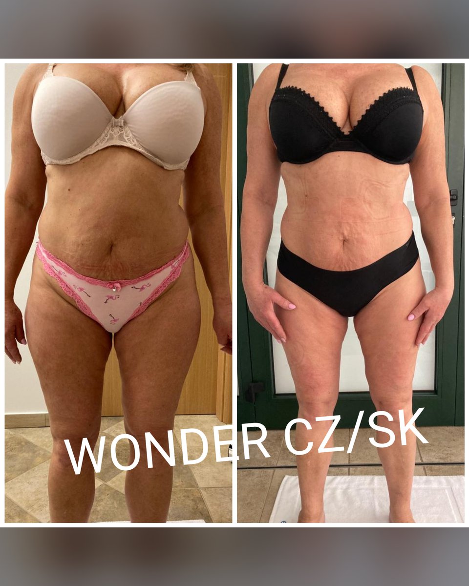Před a po protokolu Wonder Axon