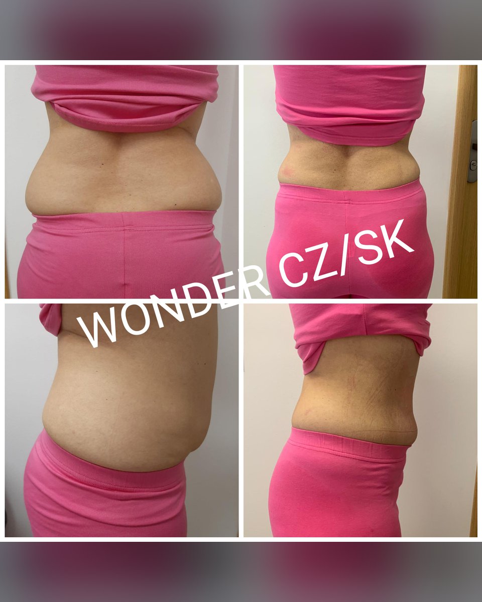 Před a po protokolu Wonder Axon