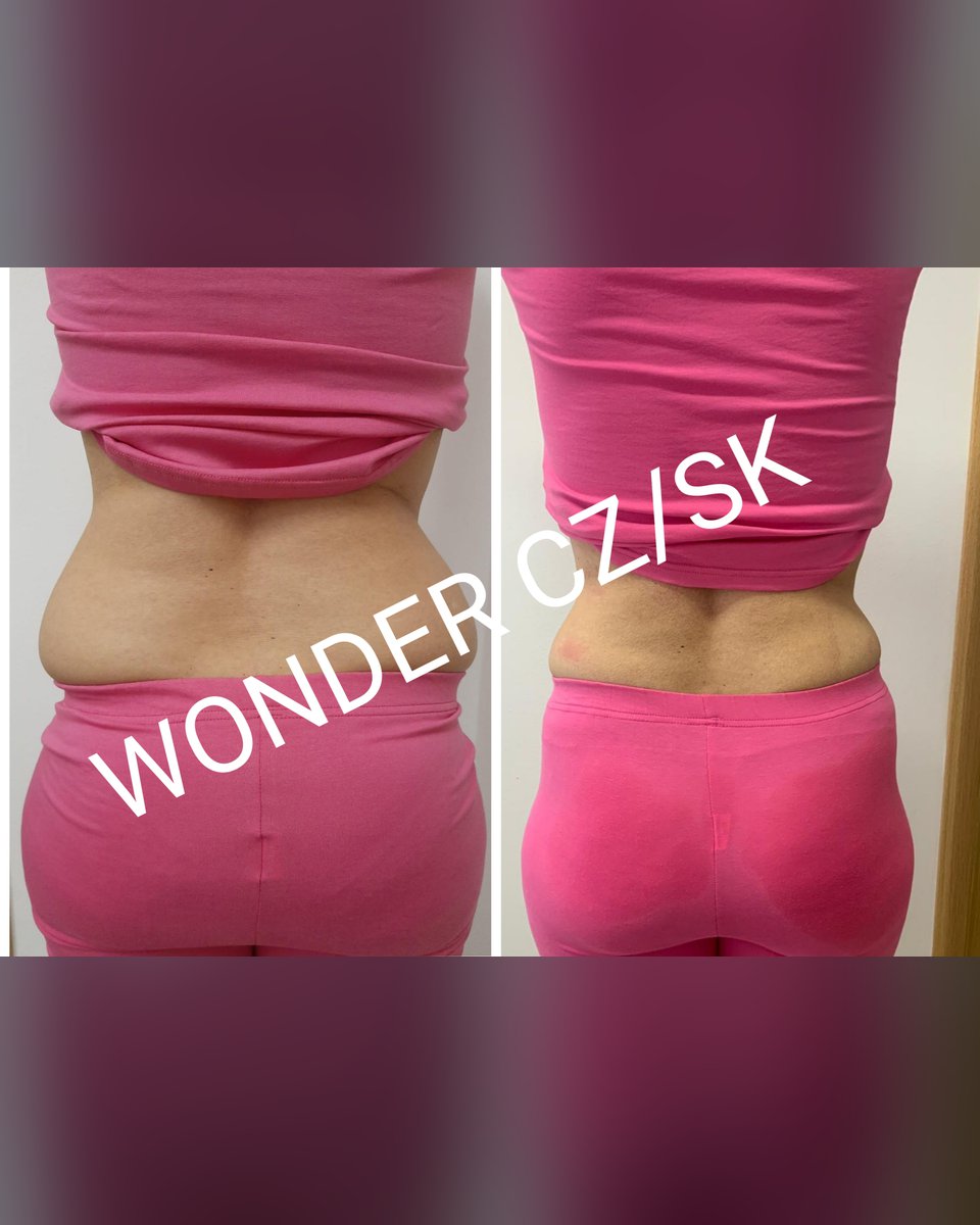 Před a po protokolu Wonder Axon