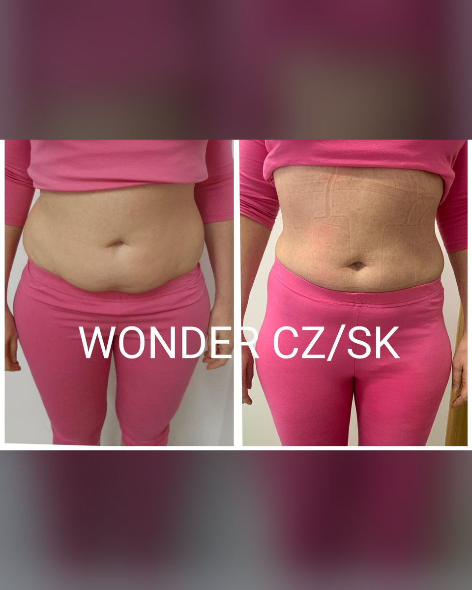 Před a po protokolu Wonder Axon