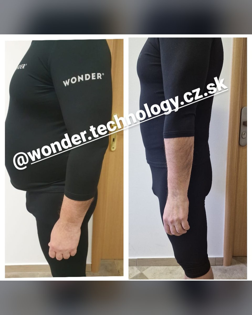 Před a po protokolu Wonder Axon