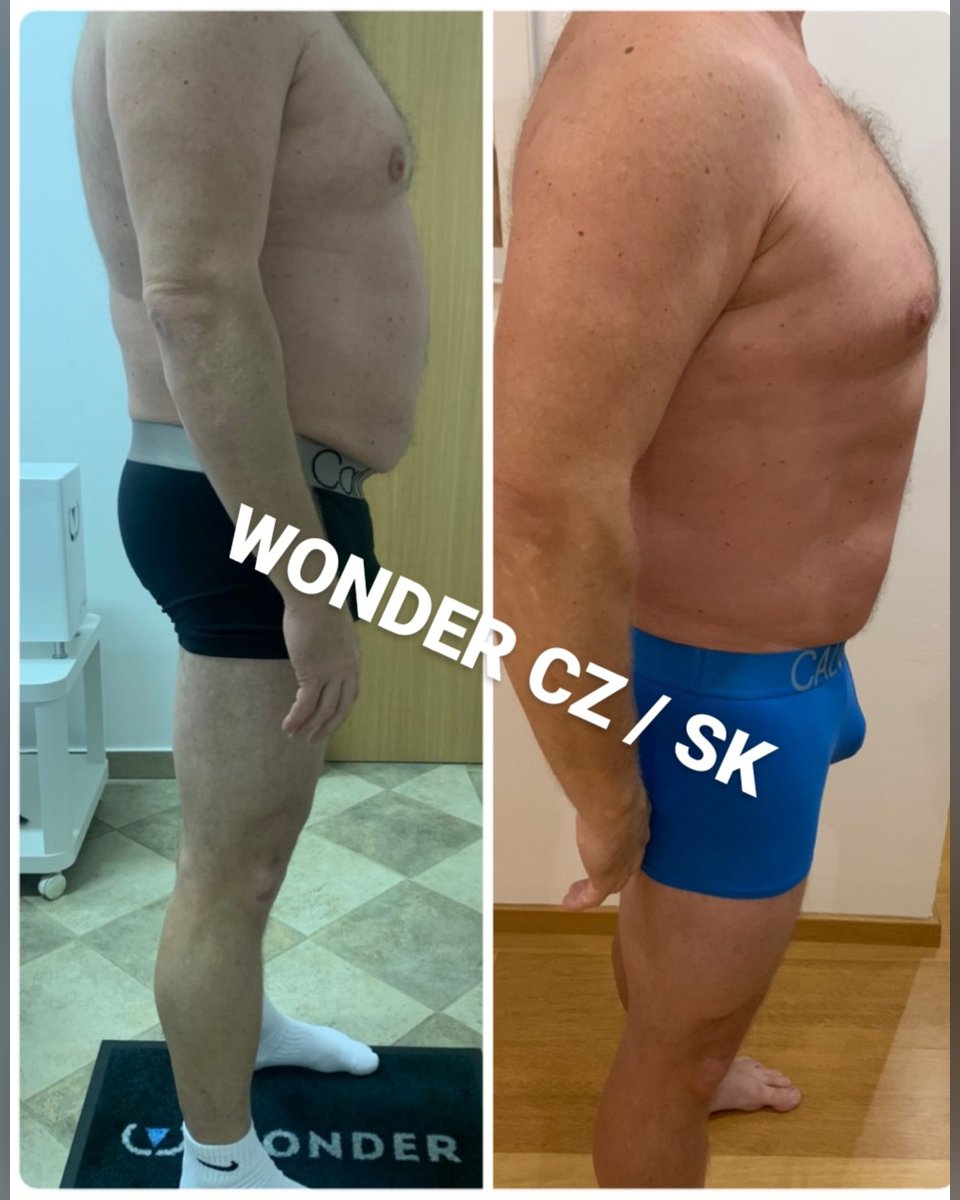 Před a po protokolu Wonder Axon