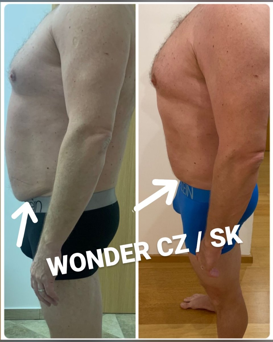 Před a po protokolu Wonder Axon